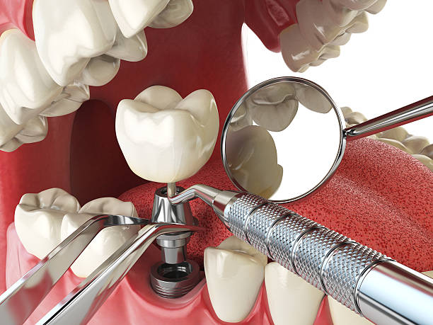 Best Emergency Cosmetic Dentistry in Pass Christian, MS